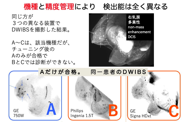 機種と精度管理により、検知能は全く異なる